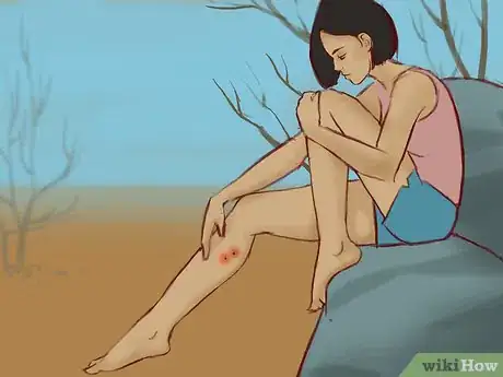 Imagen titulada Treat a Snake Bite Step 3