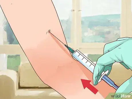 Imagen titulada Treat an Open Fracture During First Aid Step 12