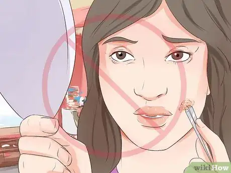 Imagen titulada Tell if You Have a Cold Sore Step 7