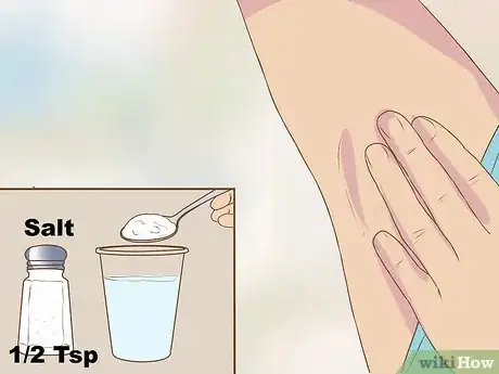 Imagen titulada Get Rid of a Zit on Your Armpit Step 4