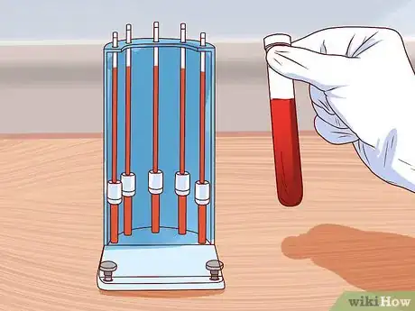 Imagen titulada Diagnose Lupus Step 11
