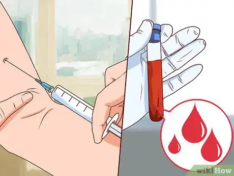 Imagen titulada Diagnose Lupus Step 10