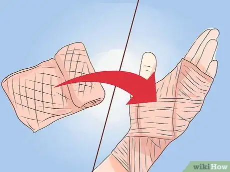 Imagen titulada Treat a Burn Using Honey Step 17