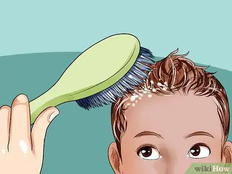 Imagen titulada Easily Clean Baby's Cradle Cap Dandruff Without Hurting the Baby Step 3