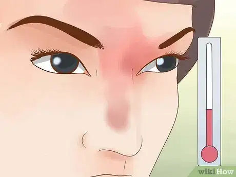 Imagen titulada Prevent Frostbite Step 3