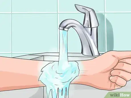 Imagen titulada Take the Sting out of a Burn Step 8