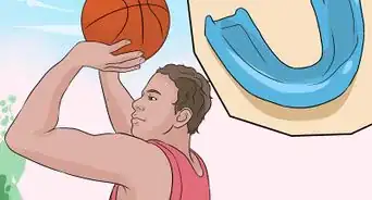 prepararte para el día en que te pongan frenillos (brackets)