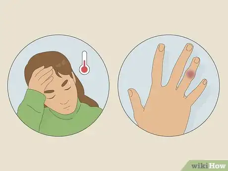 Imagen titulada Deal With the Pain of a Door Being Shut on Your Finger Step 13