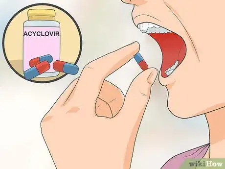 Imagen titulada Test for Herpes Step 9