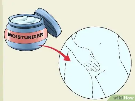 Imagen titulada Stop Vaginal Itching Step 2