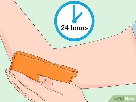 Imagen titulada Get Rid of Bruises Step 6
