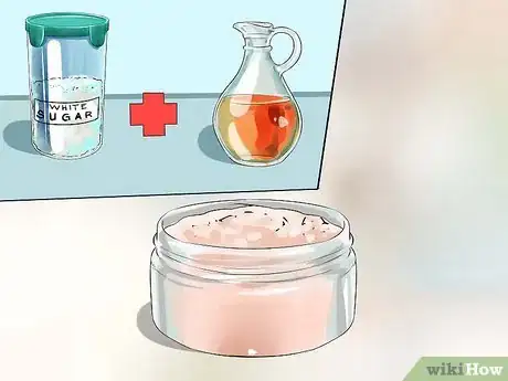 Imagen titulada Heal Dry Skin on Your Feet Step 1