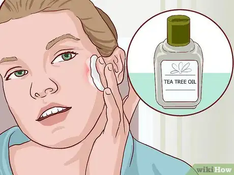 Imagen titulada Stop Recurring Boils Step 9