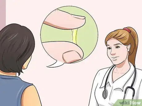 Imagen titulada Stop Vaginal Itching Step 8