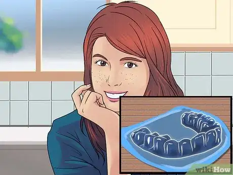 Imagen titulada Get Straight Teeth Without Braces with Invisalign Step 15