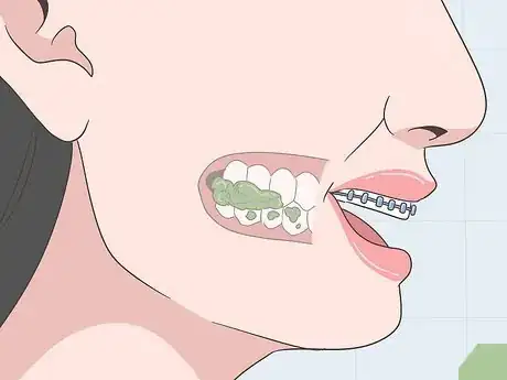Imagen titulada Eat Food With New or Tightened Braces Step 5