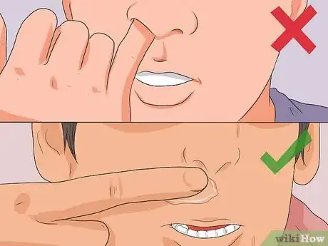 Imagen titulada Stop a Nose Bleed Step 6