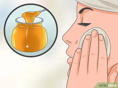 Imagen titulada Get Rid of Acne With Home Remedies Step 10