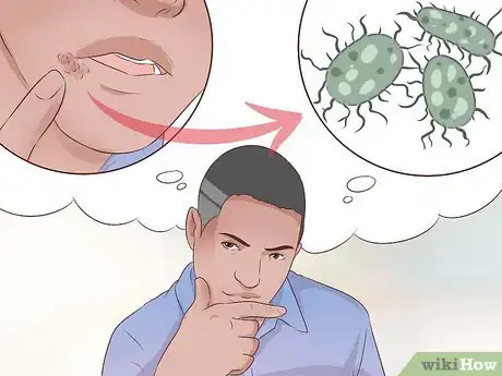 Imagen titulada Tell if You Have a Cold Sore Step 5
