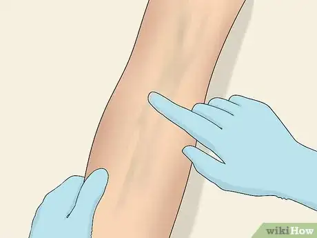 Imagen titulada Inject Into a Vein Step 9