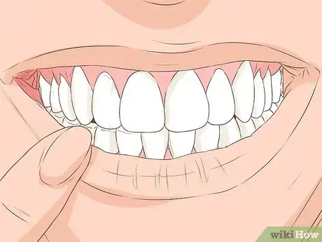 Imagen titulada Heal a Bitten Tongue Step 20
