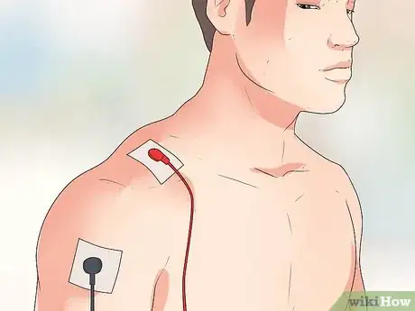 Imagen titulada Place Electrodes for a Tens Unit Step 2