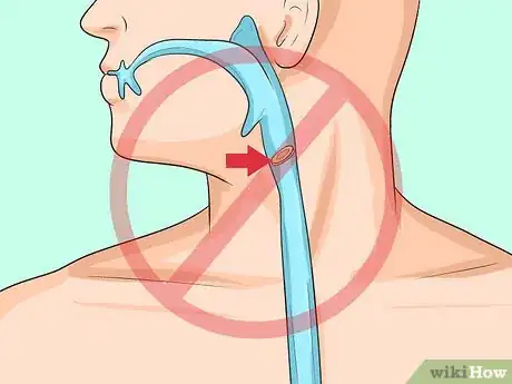 Imagen titulada Prevent Actinomycosis Step 2