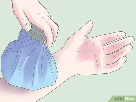 Imagen titulada Reduce Bruising Step 1