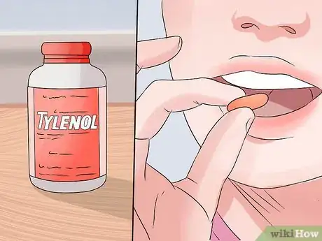 Imagen titulada Reduce Bruising Step 4