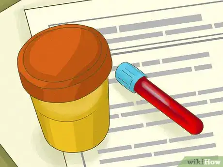 Imagen titulada Pass a Tobacco Test Step 2