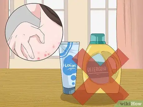 Imagen titulada Get Rid of Back Acne Fast Step 11