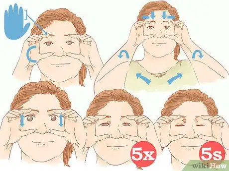 Imagen titulada Get Rid of Forehead Wrinkles Step 6