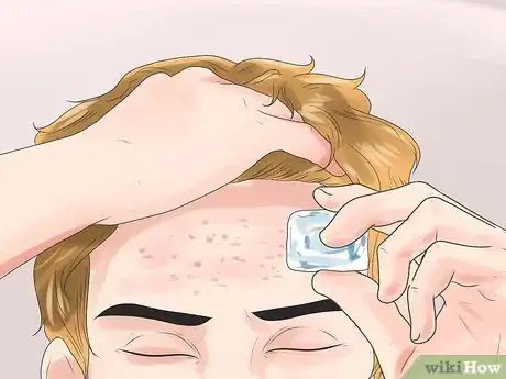 Imagen titulada Have an Acne Free Face Step 48