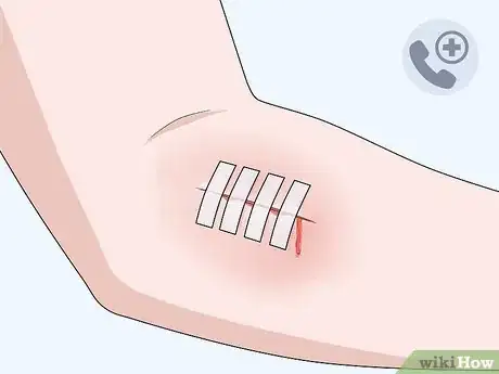 Imagen titulada Take a Shower After Surgery Step 18
