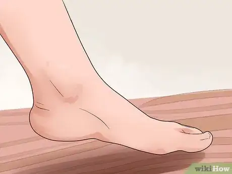 Imagen titulada Care for a Burst Blister Step 15