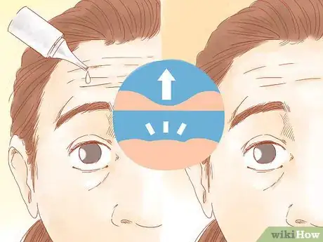 Imagen titulada Get Rid of Forehead Wrinkles Step 4