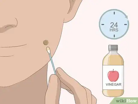 Imagen titulada Remove Moles Quickly Step 9