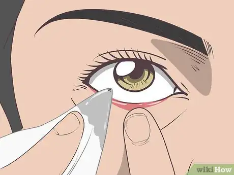 Imagen titulada Get Stuff out of Your Eye Step 13
