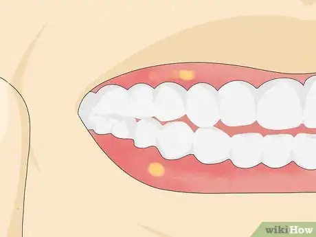 Imagen titulada Make a Fake Retainer Out of Wax Step 2