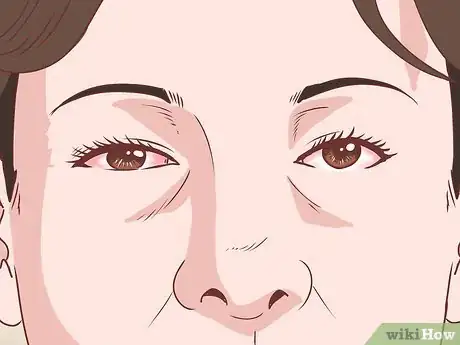 Imagen titulada Recover from Chikungunya Step 15