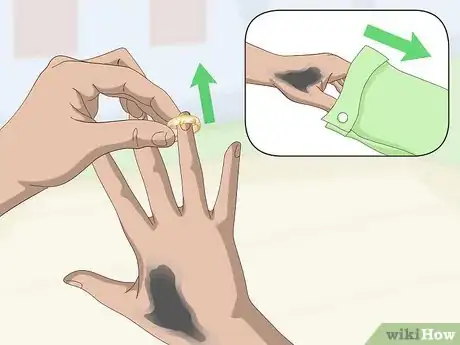 Imagen titulada Remove Tar From Skin Step 3