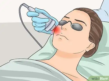 Imagen titulada Get Rid of Red Acne Marks Step 13