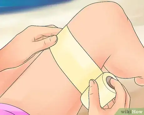 Imagen titulada Treat Jellyfish Stings Step 15