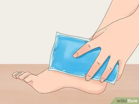 Imagen titulada Get Rid of Bruises Step 1