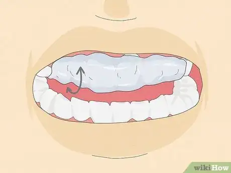 Imagen titulada Make a Fake Retainer Out of Wax Step 9