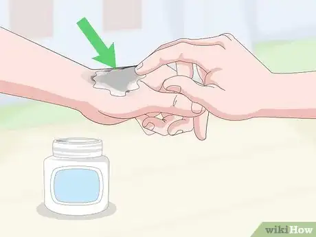 Imagen titulada Remove Tar From Skin Step 11