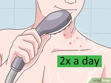 Imagen titulada Get Clear, Smooth Skin Step 8