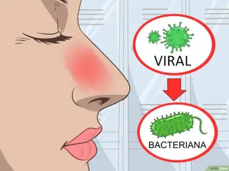 Imagen titulada Tell_a_Viral_from_a_Bacterial_Infection_Step_7