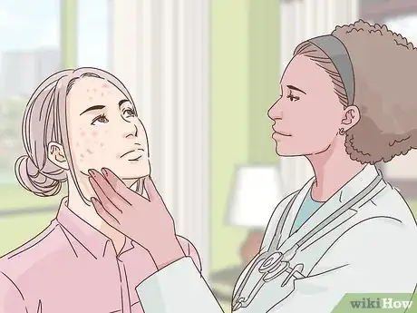 Imagen titulada Deal with the Effect of Acne on Self Esteem Step 8