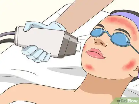 Imagen titulada Get Rid of Acne Cysts Fast Step 7